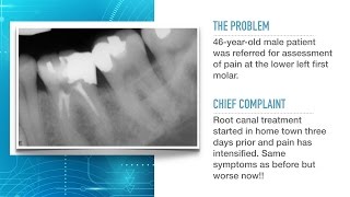 Dental Sterilization  A StepbyStep Process [upl. by Ynnam]