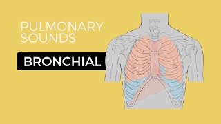 Bronchiolitis Causes Classification Symptoms Diagnosis and Treatment [upl. by Marybelle]