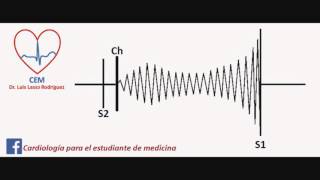 Auscultación de la Insuficiencia Mitral [upl. by Terence]