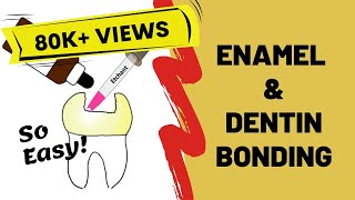 Enamel and Dentin Bonding Simplified [upl. by Silvio]