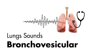 What is bronchiolitis obliterans [upl. by Caro]