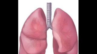 Bronchiectasis Causes amp Treatment  SLUCare Pulmonary [upl. by Eseekram]