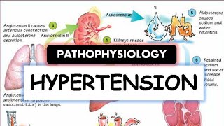 Pulmonary Hypertension Explained Clearly by MedCramcom [upl. by Aernda964]