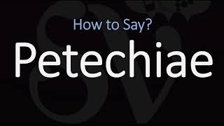 How to Pronounce Petechiae CORRECTLY Meaning amp Pronunciation [upl. by Annoynek]