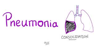 Pneumonia [upl. by Notnad]