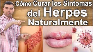 Cómo Curar y Tratar El Herpes Naturalmente [upl. by Travis]