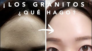 Los Granitos¿Qué hago [upl. by Irat133]