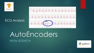 Anomaly Detection with AutoEncoders using Tensorflow [upl. by Pul]