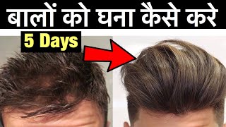 बालों को घना कैसे करे  Natural Way to Stop Hair Fall  Regrow Hair Fast How to Get Thicker Hair [upl. by Atteuqahs]