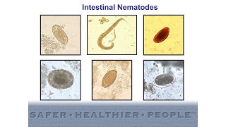 Diagnostic Features of Intestinal Nematodes [upl. by Amis]