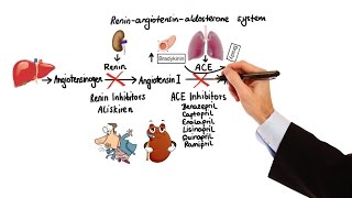 What is Hypertension [upl. by Edlitam]