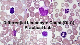 Differential Leucocyte Count DLC Practical Lab [upl. by Zackariah]