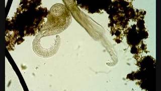 Cercaria parasite larval trematode [upl. by Ahsoet]