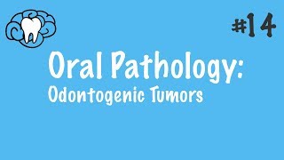 Oral Pathology  Odontogenic Tumors  INBDE ADAT [upl. by Geddes679]