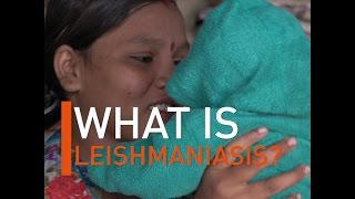 What is Leishmaniasis [upl. by Oswell]