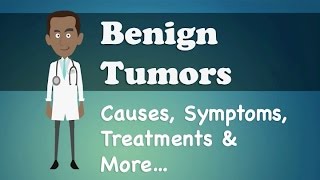 Benign Tumor Vs Malignant Tumor  Clear Comparison [upl. by Ecaidnac133]