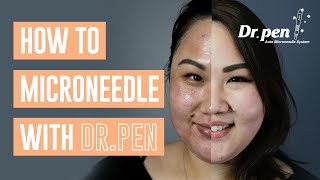 How to microneedle at home with Dr Pen  Dr Pen Australia  Microneedling  Skin Needling  CIT [upl. by Fanchette]