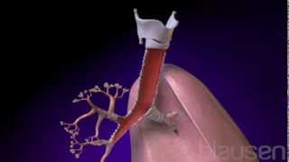 Understanding Bronchiolitis [upl. by Aiynat]