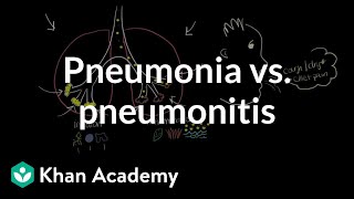 Pneumonia vs pneumonitis  Respiratory system diseases  NCLEXRN  Khan Academy [upl. by Prissie]