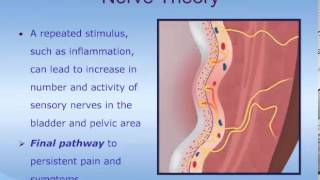 Understanding Interstitial Cystitis ICPainful Bladder Syndrome PBS [upl. by Linders220]