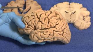 Limbic Neuroanatomy Video Lab  Brain Dissections [upl. by Kred905]