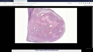 SVT 2nde  structure histologique de lovaire [upl. by Coke486]